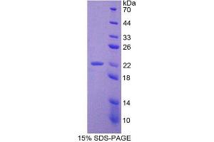 SDS-PAGE (SDS) image for Adrenomedullin (ADM) (AA 24-171) protein (His tag) (ABIN2120477)