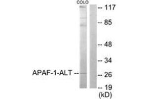 Western blot analysis of extracts from COLO205 cells, using APAF-1-ALT Antibody. (APAF1 antibody  (AA 289-338))