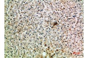 Immunohistochemical analysis of paraffin-embedded human-liver, antibody was diluted at 1:200 (TNIP2 antibody  (AA 61-110))