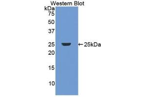 Detection of Recombinant DBP, Human using Polyclonal Antibody to Vitamin D Binding Protein (DBP) (Vitamin D-Binding Protein antibody  (AA 209-401))