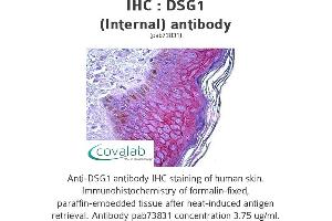 Image no. 1 for anti-Desmoglein 1 (DSG1) (Internal Region) antibody (ABIN1733615) (Desmoglein 1 antibody  (Internal Region))