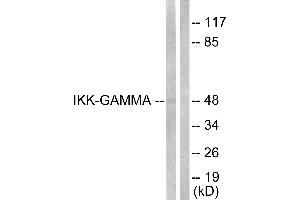 Immunohistochemical analysis of paraffin-embedded human lung carcinoma tissue using IKK-γ (Ab-31) Antibody. (IKBKG antibody  (Ser31))