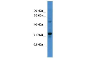 Western Blot showing TMEM176B antibody used at a concentration of 1-2 ug/ml to detect its target protein. (TMEM176B antibody  (C-Term))