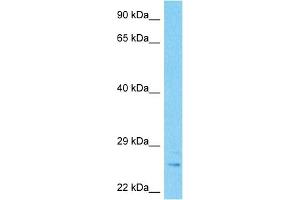 Host:  Rabbit  Target Name:  MBL2  Sample Type:  Stomach Tumor lysates  Antibody Dilution:  1. (MBL2 antibody  (N-Term))