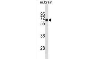 Western Blotting (WB) image for anti-Internexin Neuronal Intermediate Filament Protein, alpha (INA) antibody (ABIN2995365)