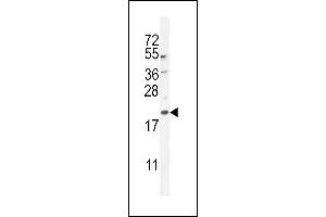 G8a/b (M1LC3A/B) 10648a western blot analysis in mouse lung tissue lysates (35 μg/lane). (MAP1LC3A/B antibody  (cleaved))