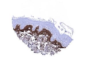 Skin Periostin is most regularly seen in a subepithelial band of variable thickness in the skin (Periostin antibody  (AA 193-326))