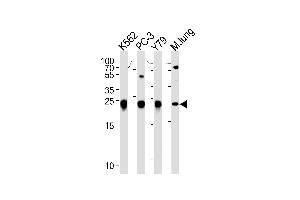GSTP1 Antibody (Center) (ABIN1881393 and ABIN2842718) western blot analysis in K562,PC-3,Y79 cell line and mouse lung tissue lysates (35 μg/lane). (GSTP1 antibody  (AA 97-126))