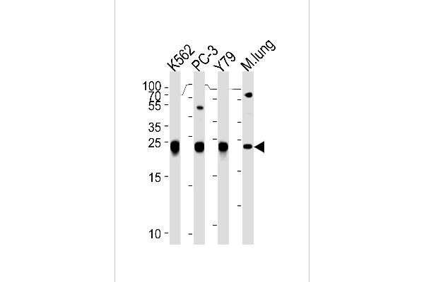 GSTP1 anticorps  (AA 97-126)