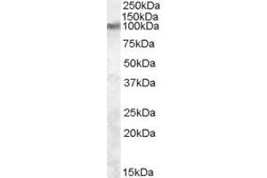 ABIN334519 (2 ug/ml) staining of Rat Brain lysate (35 ug protein in RIPA buffer). (TRPV2 antibody  (C-Term))