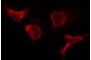 ABIN6277638 staining Hela by IF/ICC. (MCM5 antibody  (N-Term))