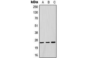 Western blot analysis of GSTM1 expression in HeLa (A), HepG2 (B), rat testis (C) whole cell lysates. (GSTM1 antibody  (Center))