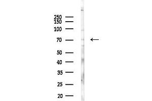 Western blot analysis of lysates from A2780 cells(UV,30 min treatment), using Phospho-SPHK2 (Ser387) Antibody at 1/1000 dilution.