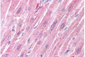 Human Heart (formalin-fixed, paraffin-embedded) stained with CRADD antibody ABIN213922 at 5 ug/ml followed by biotinylated goat anti-rabbit IgG secondary antibody ABIN481713, alkaline phosphatase-streptavidin and chromogen. (CRADD antibody  (AA 99-117))