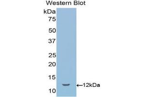 Western blot analysis of the recombinant protein. (SEMA3E antibody  (AA 581-669))