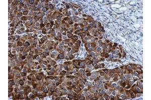 Image no. 1 for anti-Nucleolar Protein 3 (Apoptosis Repressor with CARD Domain) (NOL3) (AA 1-197) antibody (ABIN1501899) (NOL3 antibody  (AA 1-197))