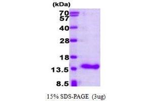 Figure annotation denotes ug of protein loaded and % gel used. (CRABP1 Protein (AA 1-137))