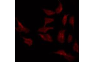 ABIN6268877 staining LOVO by IF/ICC. (MMP2 antibody)