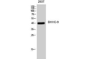 Western Blotting (WB) image for anti-Zinc Finger, DHHC-Type Containing 9 (ZDHHC9) (C-Term) antibody (ABIN3184303) (ZDHHC9 antibody  (C-Term))