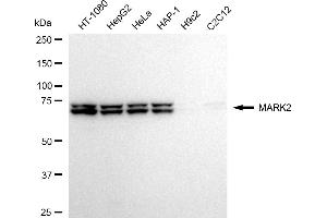 Western blotting analysis using MARK2 antibody (ABIN7799333). (Recombinant MARK2 antibody)