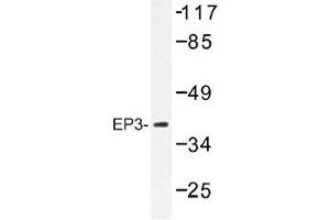 Image no. 1 for anti-Prostaglandin E Receptor 3 (Subtype EP3) (PTGER3) antibody (ABIN317859)