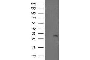 HEK293T cells were transfected with the pCMV6-ENTRY control (Left lane) or pCMV6-ENTRY ITM2B (Right lane) cDNA for 48 hrs and lysed. (ITM2B antibody)