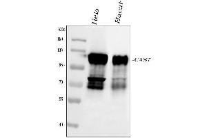 Western blot analysis of Calpastatin using anti-Calpastatin antibody (ABIN4886503). (Calpastatin antibody  (Middle Region))
