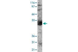 Western blot analysis of PODXL in human lung lysate using with PODXL polyclonal antibody .