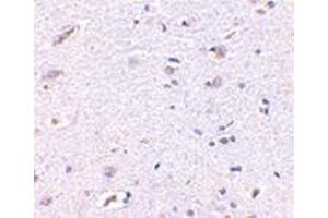 Immunohistochemistry of Syntaphilin in human brain with this product at 5 μg/ml. (Syntaphilin antibody  (N-Term))