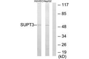 Western blot analysis of extracts from HuvEc/HepG2 cells, using SUPT3H Antibody.