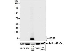 Western Blotting (WB) image for anti-Calcitonin-Related Polypeptide alpha (CALCA) (AA 75-125) antibody (ABIN7452578) (Recombinant CGRP antibody  (AA 75-125))