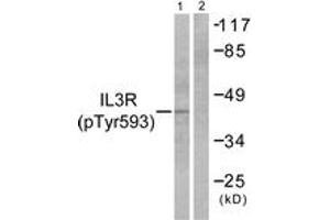 Western blot analysis of extracts from RAW264. (CSF2RB2 antibody  (pTyr593))