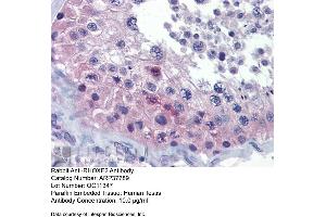 Human Testis (RHOXF2 antibody  (Middle Region))