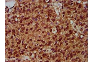 Immunohistochemistry (IHC) image for anti-Splicing Factor 3b, Subunit 1, 155kDa (SF3B1) (AA 186-378) antibody (ABIN7170618)