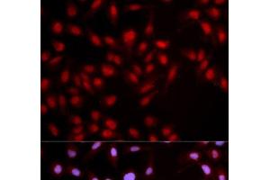 Immunofluorescence analysis of U2OS cells using Phospho-MET(Y1349) Polyclonal Antibody (c-MET antibody  (pTyr1349))