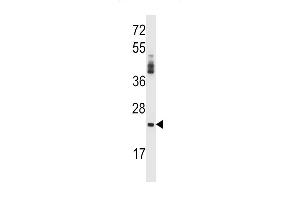 PRSS2 Antibody (Center) (ABIN657641 and ABIN2846637) western blot analysis in NCI- cell line lysates (35 μg/lane). (PRSS2 antibody  (AA 80-108))