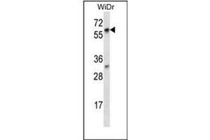 Western blot analysis of LARP7 Antibody (C-term) in WiDr cell line lysates (35ug/lane).