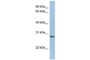 NANP antibody used at 1 ug/ml to detect target protein. (NANP antibody  (Middle Region))