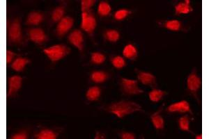 ABIN6267598 staining HeLa by IF/ICC. (NF-kB p65 antibody  (pSer311))