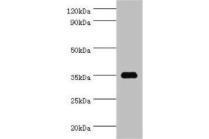 Western blot All lanes: SULT1C2 antibody at 5 μg/mL + Hela whole cell lysate Secondary Goat polyclonal to rabbit IgG at 1/10000 dilution Predicted band size: 35, 36 kDa Observed band size: 35 kDa (SULT1C2 antibody  (AA 1-120))