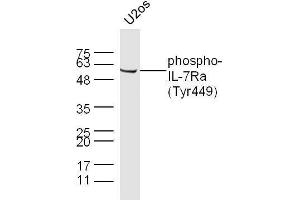 U2OS cell lysates probed with Rabbit Anti-IL-7Ra(Tyr449) Polyclonal Antibody, Unconjugated  at 1:500 for 90 min at 37˚C. (IKBKG antibody  (pSer43))