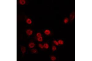 ABIN6266726 staining HT29 by IF/ICC. (TAF5L antibody  (Internal Region))