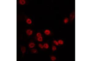 ABIN6266726 staining HT29 by IF/ICC. (TAF5L antibody  (Internal Region))