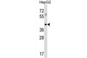 Western Blotting (WB) image for anti-Lipid Phosphate Phosphatase-Related Protein Type 5 (LPPR5) antibody (ABIN2998648) (LPPR5 antibody)
