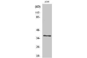 Western Blotting (WB) image for anti-Aldo-Keto Reductase Family 1, Member E2 (AKR1E2) (Internal Region) antibody (ABIN3183228)