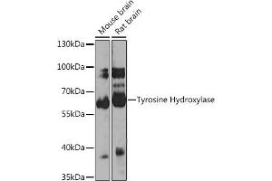 Western blot analysis of extracts of various cell lines, using Tyrosine Hydroxylase antibody (ABIN1683183, ABIN3015012, ABIN3015013 and ABIN6213590) at 1:1000 dilution. (Tyrosine Hydroxylase antibody)