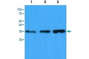 Western blot analysis of Lane 1: HeLa cell lysate, Lane 2: HepG2 cell lysate and Lane 3: 293T cell lysate with CBR1 monoclonal antibody, clone AT4E12  at 1:1000 dilution followed by HRP-conjugated goat anti-mouse secondary antibody and visualized by ECL detection system. (CBR1 antibody)