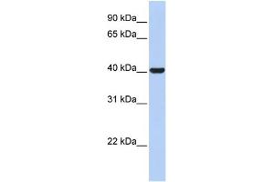 WB Suggested Anti-HSD3B1 Antibody Titration: 0. (HSD3B1 antibody  (N-Term))