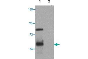 Western blot analysis of IRF4 in Jurkat cell lysate with IRF4 polyclonal antibody  at 1 ug/mL.