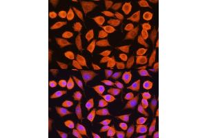 Immunofluorescence analysis of L929 cells using Cytokeratin 5 (Cytokeratin 5 (KRT5)) Rabbit pAb (ABIN3016404, ABIN3016405, ABIN3016406 and ABIN6219743) at dilution of 1:100. (Cytokeratin 5 antibody)